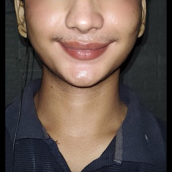Natural